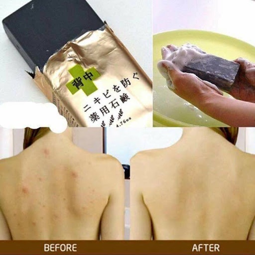 Xà phòng ngừa mụn, giảm mụn lưng Pelican For Back 135g Nhật Bản