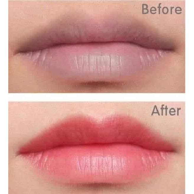 Son Dưỡng Môi Hàn Quốc Cải Thiện Nứt Nẻ, Khô Môi, Thâm Môi  Mediheal Labo care Panteno Lips.