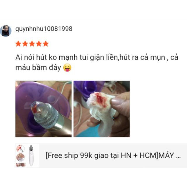 máy hút mụn cầm tay hút siêu mạnh RT-8080 MỚI NHẤT