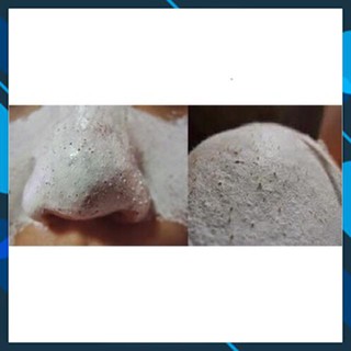 Mỹ Phẩm  Gel lột mụn FOCI PEELING PACK