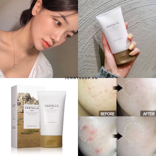 Kem Giảm Mụn, Làm Dịu Da Chiết Xuất Rau Má Skin1004 Madagascar Centella Asiatica 100 Cream 75g | BigBuy360 - bigbuy360.vn