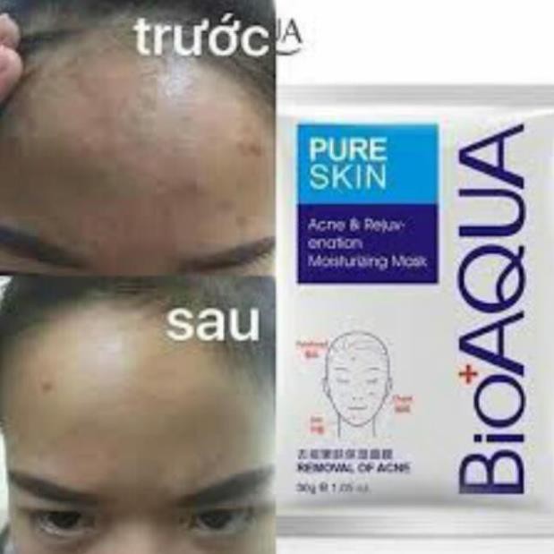 Mặt nạ bạc dùng cho da mụn đỏ mask Pure Skin Bioaqua