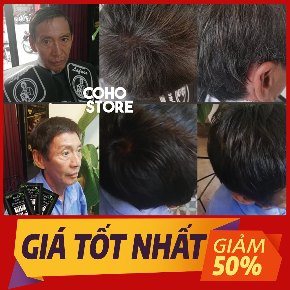 [HÀNG ANH QUỐC] Dầu gội nhuộm tóc đen thảo dược DEXE GIÁ 1 HỘP 10 GÓI | BigBuy360 - bigbuy360.vn