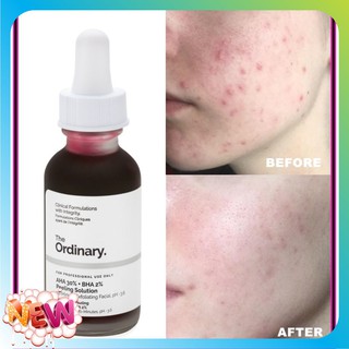 [Shopee Trợ Giá] The Ordinary AHA 30% + BHA 2% Peeling Solution Tẩy Tế Bào Chết Thay Da Hóa Học