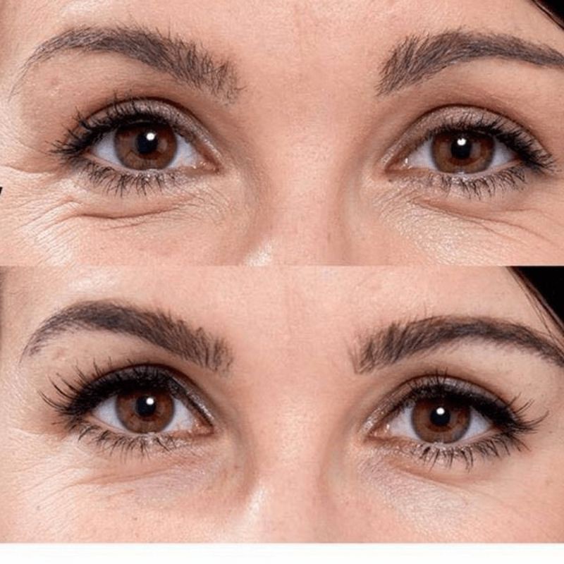 Elizabeth Arden ✨ Tinh chất dưỡng mắt trẻ hóa da  Advanced Ceramide Capsules Daily Youth Restoring Eye Serum