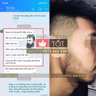 Dầu dưỡng râu Beard oil