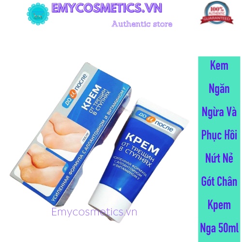 Kem Ngăn Ngừa Và Phục Hồi Nứt Nẻ Gót Chân Kpem Nga 50ml