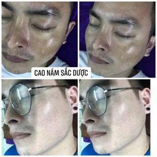 Kem Sắc Dược Ngừa Nám Sạm