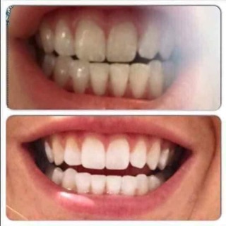 Than hoạt tính trắng răng #tanoshi