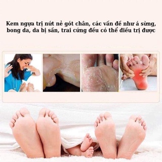 Kem dầu nứt nẻ hiệu quả (30gr)