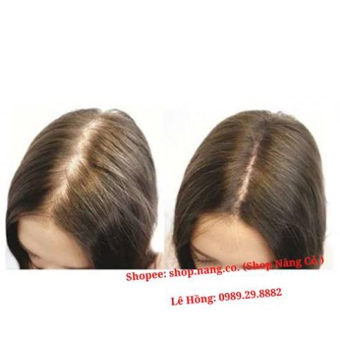 [Chính Hãng] Phân loại Combo Tinh dầu vỏ bưởi, Dầu gội hoa bưởi, Dầu xả dừa, Kích mọc tóc dày dài, Ngăn rụng tóc hói đầu | BigBuy360 - bigbuy360.vn