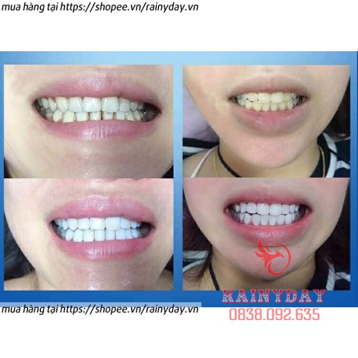 Hộp 14 miếng dán trắng răng tiện lợi 3D White Teeth Whitening Strips dán tẩy trắng răng nội địa trung