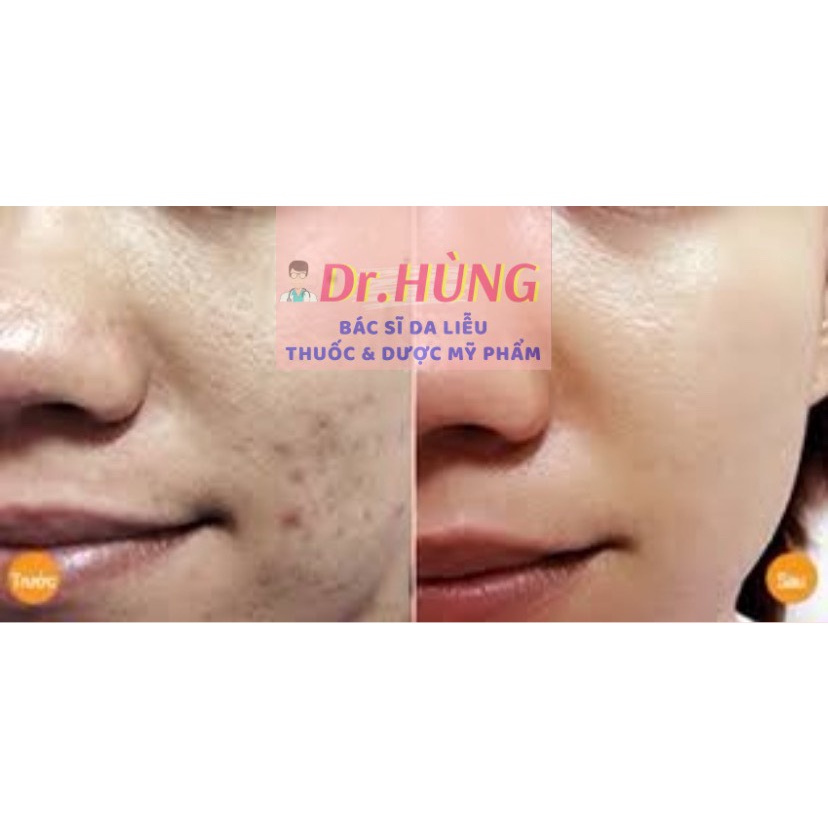 ✅(CHÍNH HÃNG) Serum Dưỡng B5 Mediphar Cấp Ẩm, Phục Hồi Trắng Sáng Da 30ml