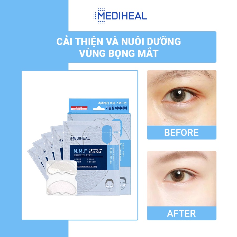 Mặt Nạ Cấp Ẩm Cho Mắt Mediheal N.M.F Aquaring Gel Eye Fill Patch Hộp 5 Túi [K32]