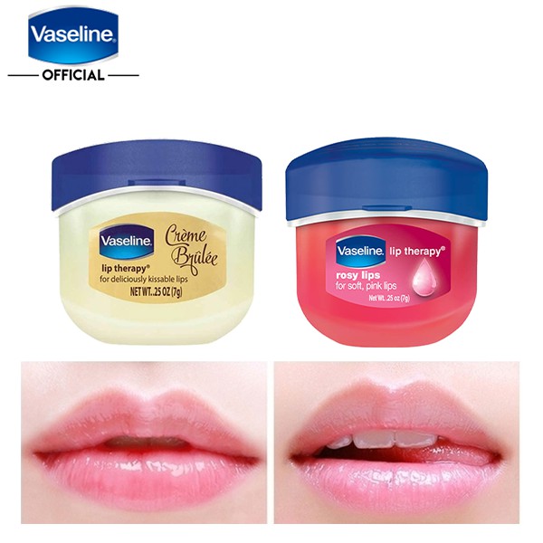 Son dưỡng môi Vaseline Lip Therapy 7g