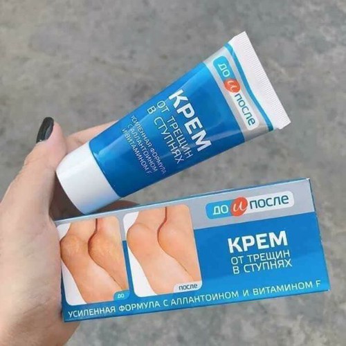 Kem Ngăn Ngừa Và Hồi Phục Nứt Nẻ Gót Chân Kpem Nga 50ml