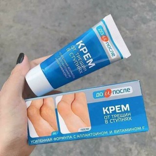 Kem trị nứt gót chân Apteka Nga