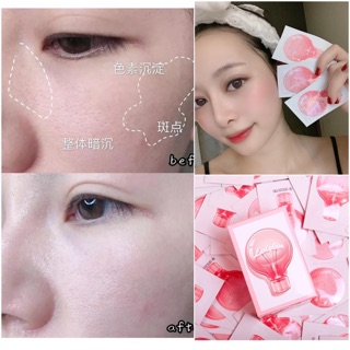 Tinh chất Ladyskin cho da mụn