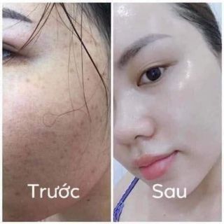 Kem collagen plus vit e chính hãng