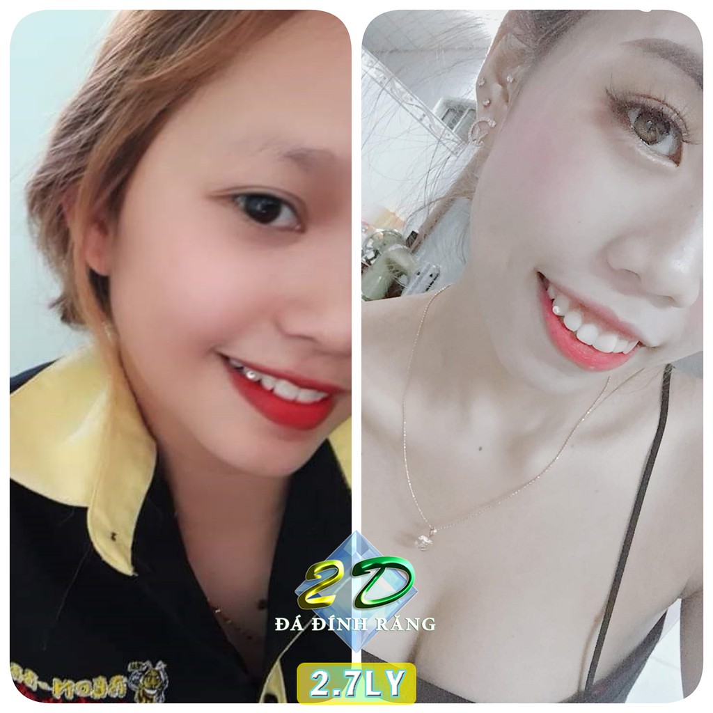 Đá dán răng CAO CẤP loại đế bằng đính tại nhà hộp 3 viên đủ size + keo dán