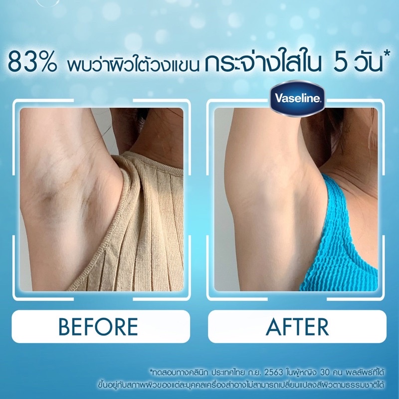 Kem Dưỡng Da Vùng Nách Vaseline Dry Serum Thái Lan 50ml