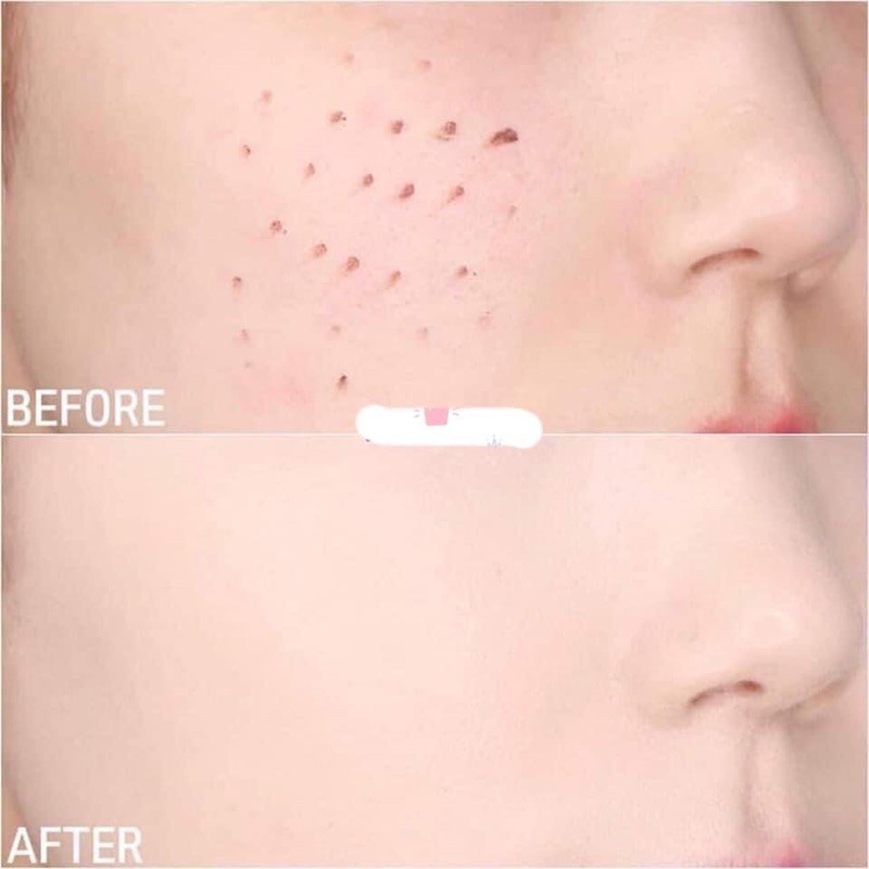 Cushion Clio Kill cover founwear XP | BigBuy360 - bigbuy360.vn