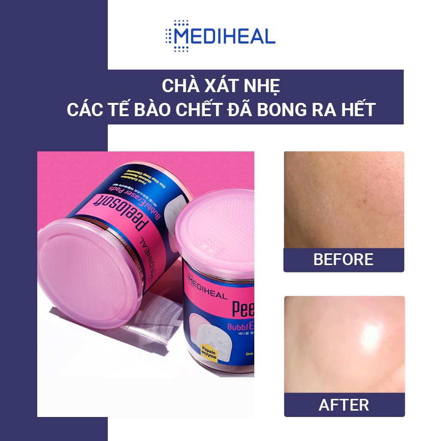 Hộp 20 Miếng Tẩy Tế Bào Chết Mediheal Peelosoft Bubbl Eraser Pads 20 pads