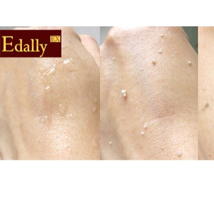 Gel tẩy da chết dưỡng ẩm và làm sáng da Edally Hàn Quốc - Smoothing Peeling Gel 120ml