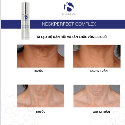 Kem dưỡng iS CLINICAL NeckPerfect Complex nâng cơ và săn chắc da vùng cổ 50g