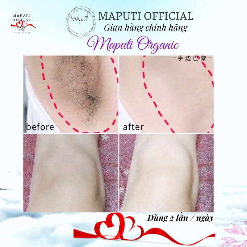 Kem hồng vùng kín Maputi, giảm thâm nhũ hoa nách Nhật Bản 100ml