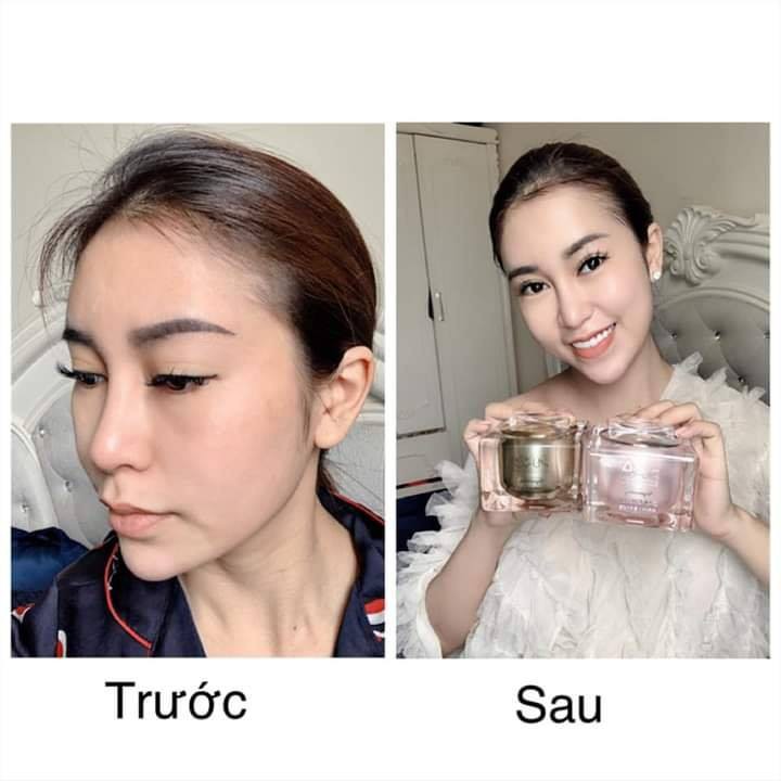 KEM MỘC QUA,KEM PURE NIGHT CREAM,Ceo Ngọc Trinh-Mỹ Nhân  Shop