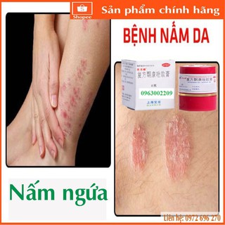 Kem Bôi Nấm Da Cực Kỳ Hiệu Qủa [ Bảo Long Khang ]