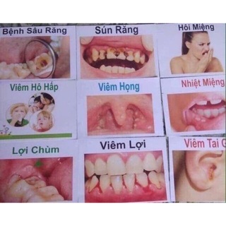 tinh dầu răng miệng