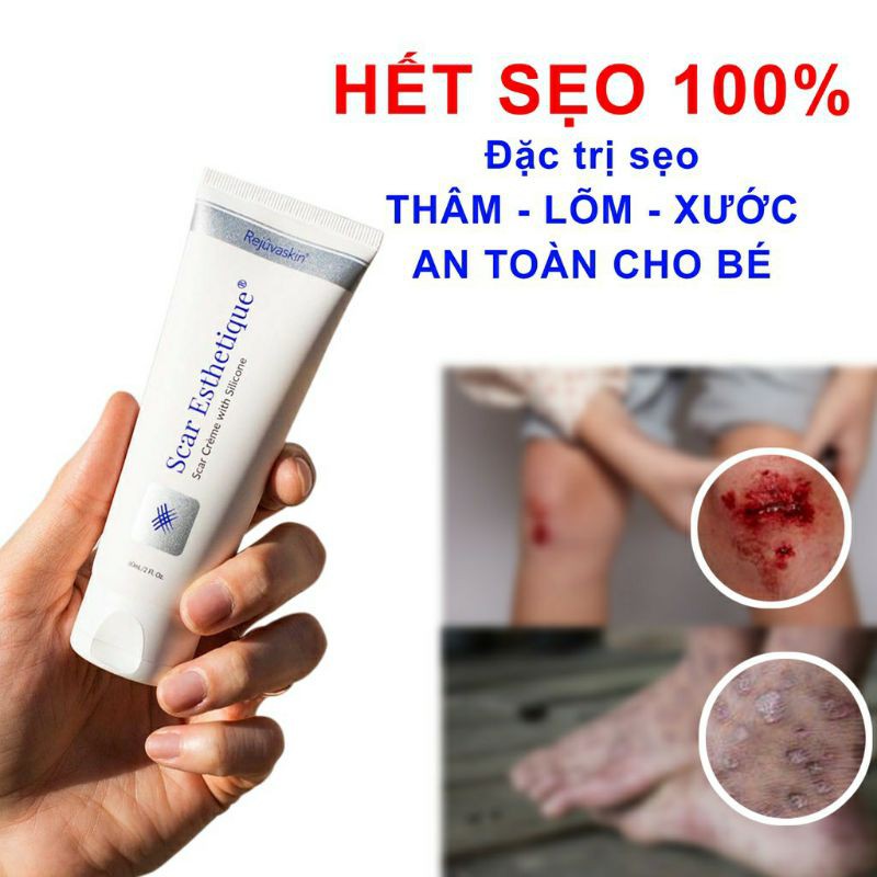 CHÍNH HÃNG - Scar Esthetique 30ml, kem xóa sẹo của mỹ