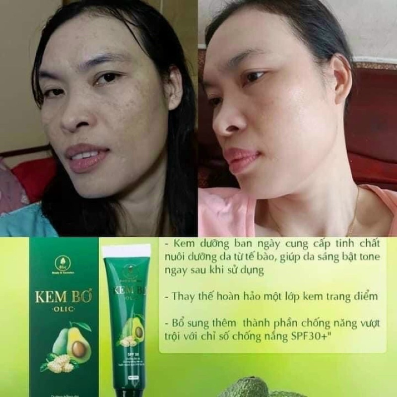 Kem Bơ Cấy Trắng Nano Olic
