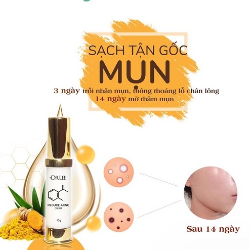Kem ngừa mụn đẩy nhân mụn, mờ thâm +Dr.Lee Cream.