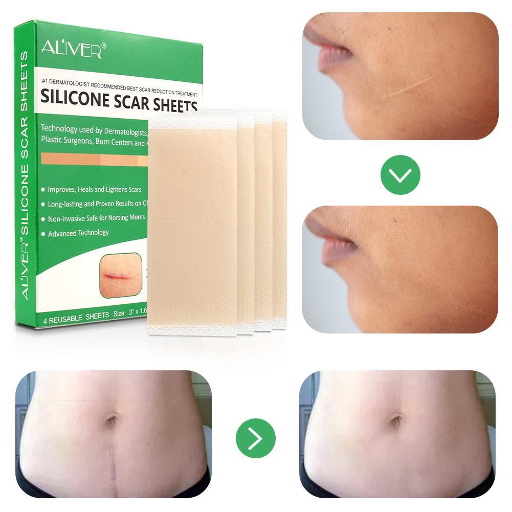 Miếng dán giảm sẹo Aliver K0W4 chất liệu silicon tiện dụng