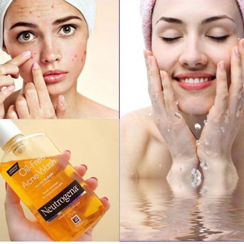 Sữa rữa mặt hỗ trợ giảm mụn Neutrogena Oil Free Acne Wash 269ml