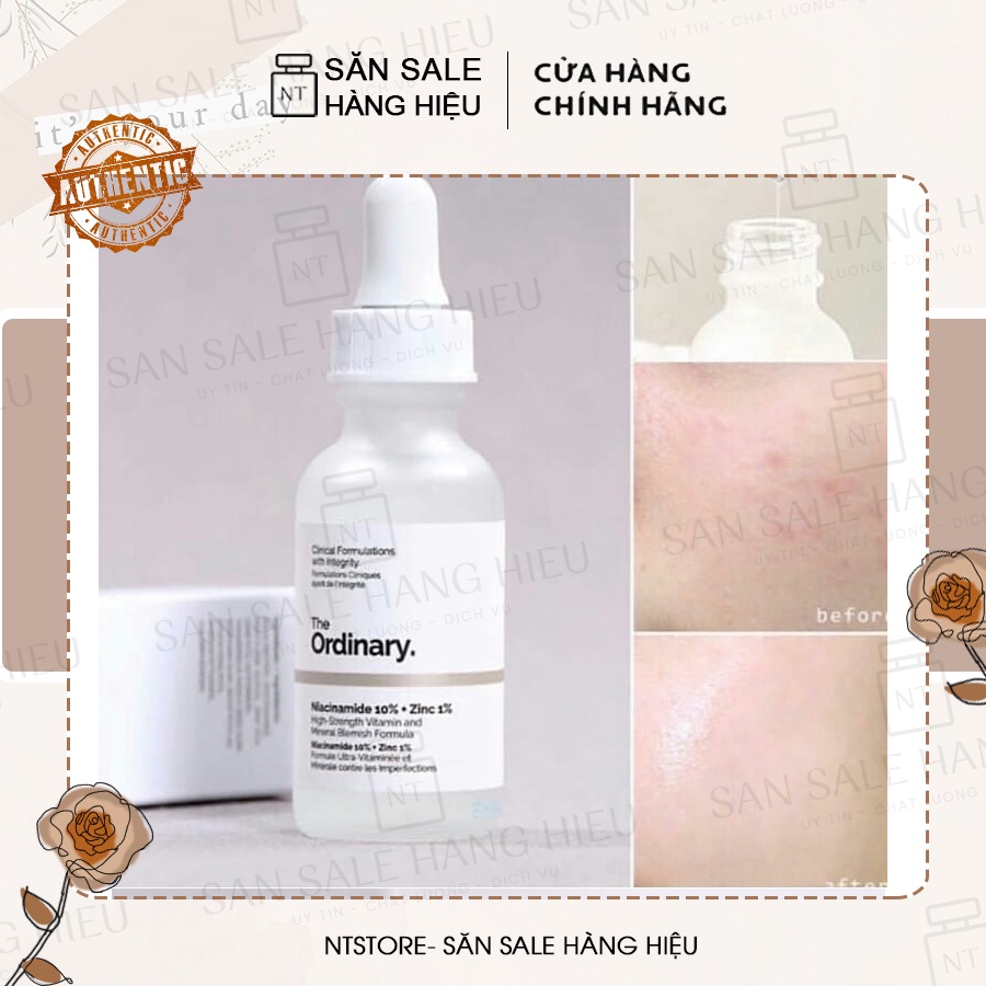 Serum The Ordinary Niacinamide 10% Và Zinc 1% Giúp Cân Bằng Bã Nhờn Làm Sáng Da Thu Nhỏ Lỗ Chân Lông 30ml