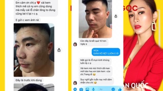 Cao mụn sâm đỏ