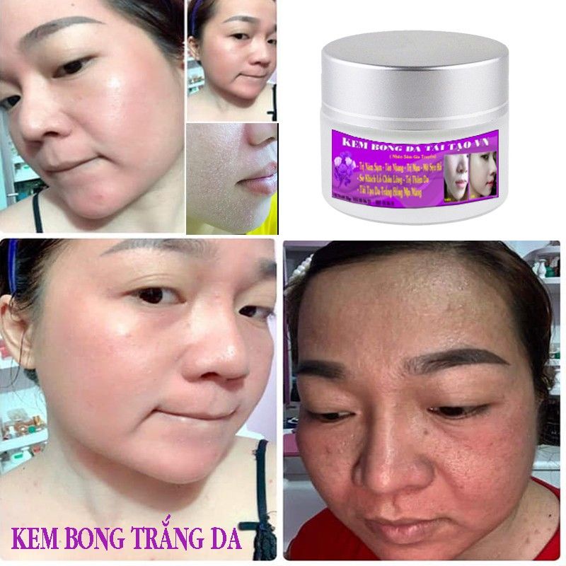 Kem Bong Da Tái Tạo VN