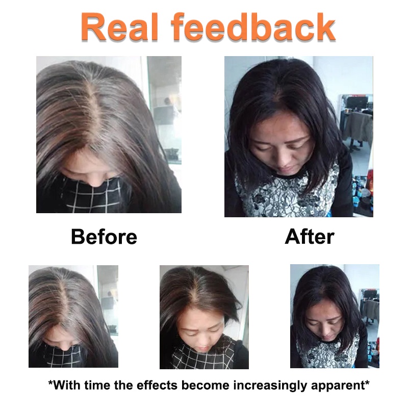 Tinh chất đen tóc Dầu dưỡng tóc ủ tóc phục hồi hư tổn serum dưỡng tóc dầu xả tóc Xịt tóc đen xịt mọc tóc 100ml | BigBuy360 - bigbuy360.vn