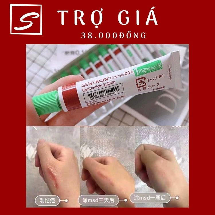 [Mã INCU1708 hoàn 15K xu đơn 50K] [AUTH] KEM NGĂN NGỪA MỤN, KEM LÀM MỜ SẸO GENTACIN 10g NHẬT BẢN | BigBuy360 - bigbuy360.vn