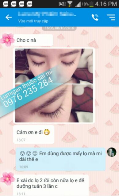 Lumigan Thuốc mọc dài mi của Mỹ | BigBuy360 - bigbuy360.vn