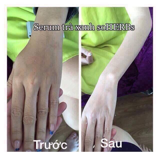 Serum Body Trà Xanh soHERBs