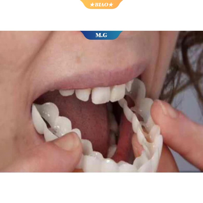 Bộ 2 Cặp Răng Giả Veneers Trắng Giả Tạm Thời Hoàn Hảo Thoải Mái Vừa Vặn