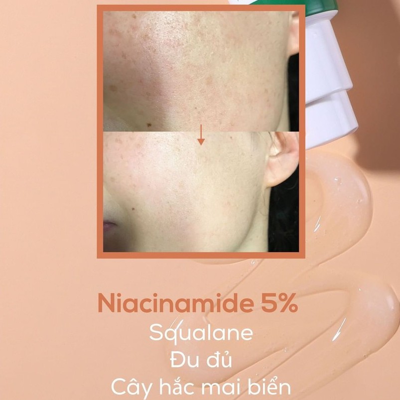 Tinh Chất Giảm Thâm Mụn AXIS -Y Dark Spot Correcting Glow Serum | BigBuy360 - bigbuy360.vn