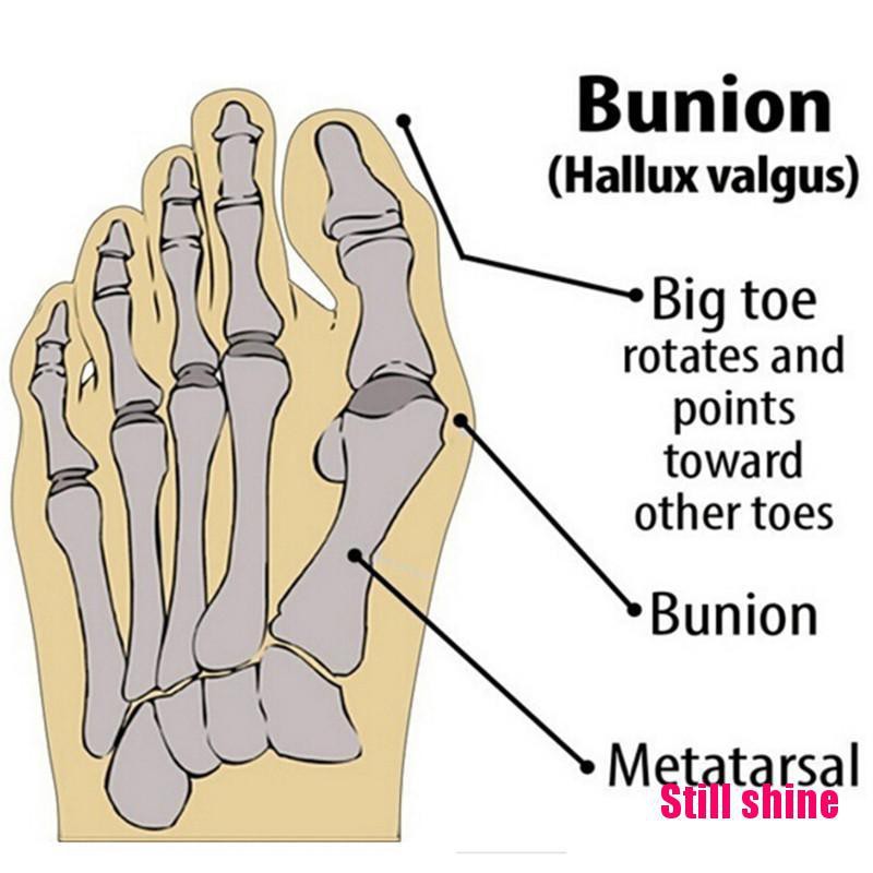 Cặp đai quấn bảo vệ chân hiệu quả