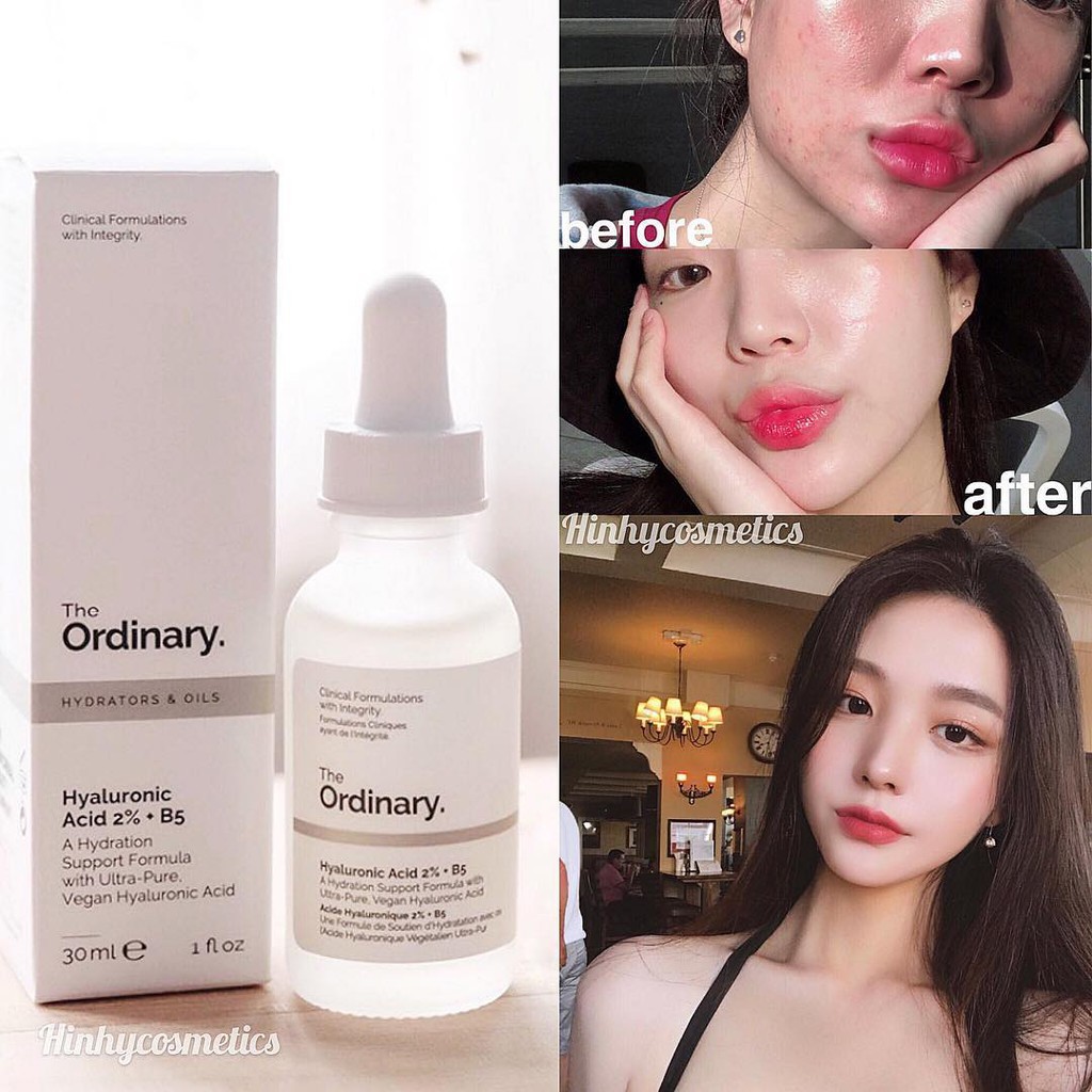 Tinh chất cấp nước, phục hồi da The Ordinary Hyaluronic Acid 2% + B5