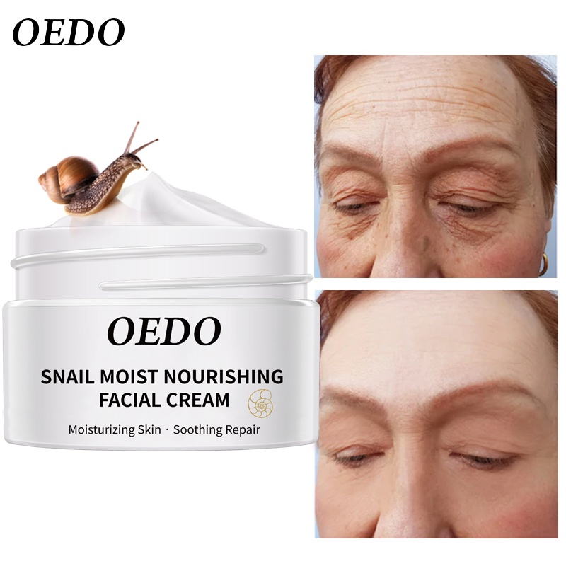 Kem dưỡng tinh chất ốc sên đàn hồi chăm sóc da OEDO cung cấp nước cho da căng mịn ẩm mượt Da săn chắc Chống lão hóa làm trắng da hiệu quả trẻ hoá da Skin Conditioning 40g